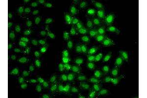 Immunofluorescence analysis of U2OS cells using PSMD8 antibody. (PSMD8 anticorps)