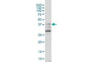 DNAJB2 monoclonal antibody (M03), clone 2C9 Western Blot analysis of DNAJB2 expression in A-431 .