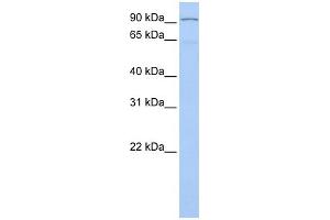 WB Suggested Anti-LZTR1 Antibody Titration:  0. (LZTR1 anticorps  (N-Term))