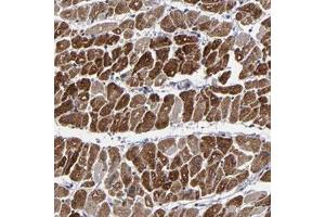 Immunohistochemical staining of human heart muscle with ZNF175 polyclonal antibody  shows strong cytoplasmic positivity in myocytes . (ZNF175 anticorps)