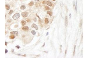 Immunohistochemistry (IHC) image for anti-Ubiquitin C (UBC) (AA 1-100) antibody (ABIN1683190)