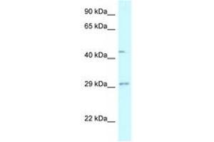 Image no. 1 for anti-Fucosyltransferase 8 (Alpha (1,6) Fucosyltransferase) (FUT8) (AA 27-76) antibody (ABIN6747582) (FUT8 anticorps  (AA 27-76))