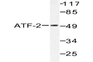 Image no. 2 for anti-Activating Transcription Factor 2 (ATF2) antibody (ABIN265319) (ATF2 anticorps)