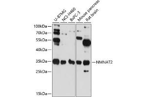 Western blot analysis of extracts of various cell lines, using NMN antibody (ABIN6129063, ABIN6144684, ABIN6144685 and ABIN6217965) at 1:3000 dilution. (NMNAT2 anticorps  (AA 1-302))