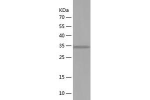 Western Blotting (WB) image for Natriuretic Peptide A (NPPA) (AA 25-150) protein (His-IF2DI Tag) (ABIN7124115)