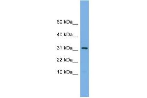 WB Suggested Anti-MRPS6 Antibody Titration: 0. (MRPS6 anticorps  (C-Term))