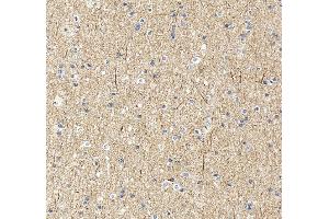 IHC analysis of UBE3A using anti-UBE3A antibody (ABIN7599562). (ube3a anticorps  (AA 1-860))