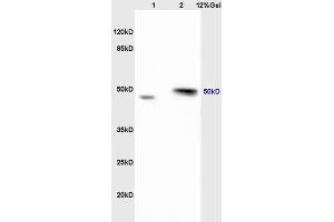 Lane 1: mouse intestine lysates Lane 2: mouse brain lysates probed with Anti Ribonuclease Inhibitor Polyclonal Antibody, Unconjugated (ABIN872914) at 1:200 in 4 °C.