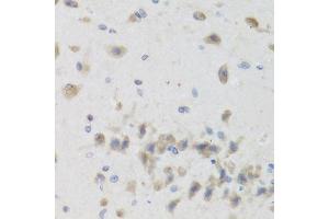 Immunohistochemistry of paraffin-embedded mouse brain using ISG15 Antibody.