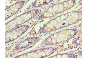Immunohistochemistry of paraffin-embedded human colon tissue using ABIN7171070 at dilution of 1:100