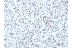 ABIN6383887 to MyoD1 was successfully used to stain human rhabdomyosarcoma sections.