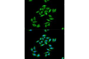 Immunofluorescence (IF) image for anti-Carnitine Palmitoyltransferase 1A (Liver) (CPT1A) antibody (ABIN1876495) (CPT1A anticorps)
