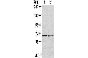 Gel: 6 % SDS-PAGE,Lysate: 40 μg,Lane 1-2: 293T cells, HepG2 cells,Primary antibody: ABIN7191487(MMP24 Antibody) at dilution 1/200 dilution,Secondary antibody: Goat anti rabbit IgG at 1/8000 dilution,Exposure time: 40 seconds