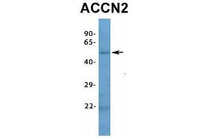 Host:  Rabbit  Target Name:  ACCN2  Sample Type:  Human Fetal Muscle  Antibody Dilution:  1.