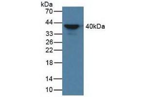 Detection of aZGP1 in Human Serum using Polyclonal Antibody to Alpha-2-Glycoprotein 1, Zinc Binding (aZGP1) (AZGP1 anticorps  (AA 148-298))