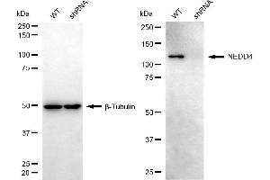 Western blotting analysis using NEDD4 antibody (ABIN7799573).