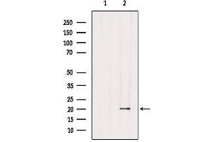 Western blot analysis of extracts from 3t3, using MID1IP1 Antibody. (m1ip1 anticorps  (Internal Region))