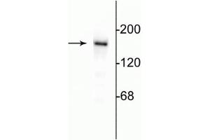 Western blot of 10 µg of rat hippocampal lysate showing specific immunolabeling of the ~180 kDa NR2B subunit of the NMDA receptor. (GRIN2B anticorps  (C-Term))