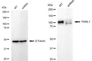 Western blotting analysis using PIWIL1 antibody (ABIN7799840). (Recombinant PIWIL1 anticorps)