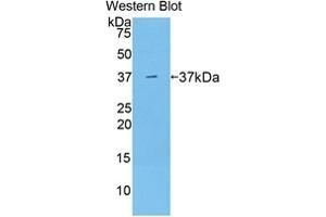 Detection of Recombinant ARG, Mouse using Polyclonal Antibody to Arginase (ARG) (ARG anticorps  (AA 1-323))