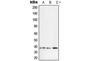 Western blot analysis of SFRP2 expression in SKNSH (A), Jurkat (B), A431 (C) whole cell lysates.