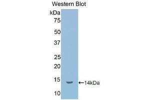 Detection of Recombinant IL1R1, Human using Polyclonal Antibody to Interleukin 1 Receptor Type I (IL1R1)
