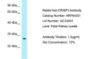 Western Blotting (WB) image for anti-Cysteine-Rich Secretory Protein 3 (CRISP3) (N-Term) antibody (ABIN2789797) (CRISP3 anticorps  (N-Term))