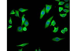 Immunofluorescence staining of HepG2 Cells with ABIN7127435 at 1:50, counter-stained with DAPI. (Recombinant PTGS2 anticorps)