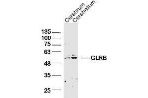 Lane 1: Mouse Cerebrum; Lane 2: Mouse Cerebellum lysates probed with GLRB Polyclonal Antibody, Unconjugated (bs-20450R) at 1:300 overnight at 4˚C. (GLRB anticorps  (AA 51-150))