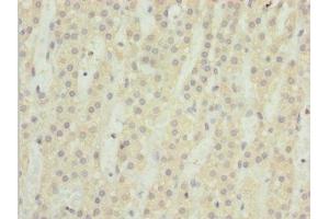 Immunohistochemistry of paraffin-embedded human adrenal gland tissue using ABIN7172947 at dilution of 1:100