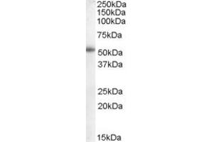 Western Blotting (WB) image for anti-Epithelial Splicing Regulatory Protein 2 (ESRP2) (N-Term) antibody (ABIN2780318) (ESRP2 anticorps  (N-Term))