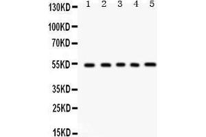 Anti- Vitronectin Picoband antibody, Western blotting All lanes: Anti Vitronectin  at 0. (Vitronectin anticorps  (C-Term))