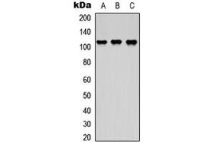 Western blot analysis of DDEF2 expression in HEK293T (A), NS-1 (B), H9C2 (C) whole cell lysates. (ASAP2 anticorps  (Center))