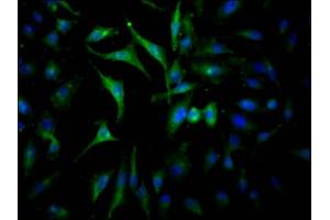 Immunofluorescence staining of Hela Cells with ABIN7127587 at 1:50, counter-stained with DAPI. (Recombinant JAK2 anticorps)