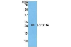 Detection of Recombinant IL17RE, Rat using Polyclonal Antibody to Interleukin 17 Receptor E (IL17RE) (IL17RE anticorps  (AA 457-626))