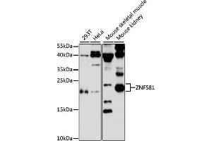 Western blot analysis of extracts of various cell lines, using ZNF581 antibody (ABIN6128960, ABIN6150520, ABIN6150521 and ABIN6217055) at 1:3000 dilution. (ZNF581 anticorps  (AA 1-90))