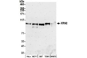 anti-5'-3' Exoribonuclease 2 (XRN2) (AA 1-50) antibody