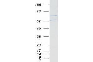 Validation with Western Blot