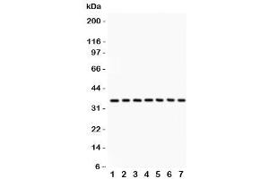 Western blot testing of PP2A antibody and Lane 1:  rat kidney