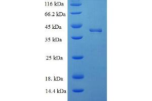 SDS-PAGE (SDS) image for Docking Protein 5 (DOK5) (AA 1-198), (Isoform 2) protein (His-SUMO Tag) (ABIN5709417)