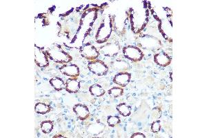 Immunohistochemistry of paraffin-embedded rat kidney using NDUFV1 Rabbit pAb  at dilution of 1:100 (40x lens).