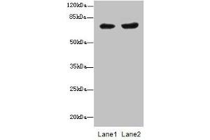 Western blot All lanes: PGM2L1 antibody at 0. (PGM2L1 anticorps  (AA 101-400))