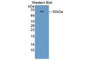 Detection of Recombinant STAR, Human using Polyclonal Antibody to Steroidogenic Acute Regulatory Protein (STAR) (STAR anticorps  (AA 1-285))