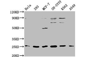 Western Blot Positive WB detected in: Hela whole cell lysate, 293 whole cell lysate, MCF-7 whole cell lysate, SH-SY5Y whole cell lysate, K562 whole cell lysate, A549 whole cell lysate All lanes: ARHGDIG antibody at 1:2000 Secondary Goat polyclonal to rabbit IgG at 1/50000 dilution Predicted band size: 26 kDa Observed band size: 26 kDa (ARHGDIG anticorps  (AA 1-225))