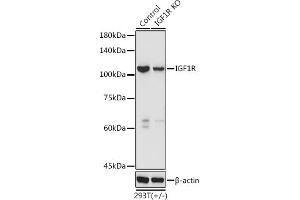 Western blot analysis of extracts of 293T cells, using IGF1R antibody (ABIN3020767, ABIN3020768, ABIN3020769 and ABIN6213714) at 1:3000 dilution.