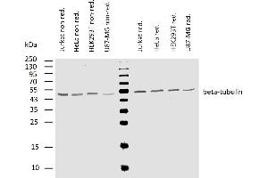 Western blotting analysis of human beta-tubulin using mouse monoclonal antibody TU-06 on lysates (50 mM TRIS-Cl pH  6.