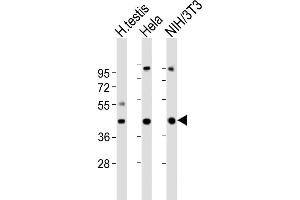 All lanes : Anti-GNA11 Antibody (Center) at 1:2000 dilution Lane 1: human testis lysates Lane 2: Hela whole cell lysates Lane 3: NIH/3T3 whole cell lysates Lysates/proteins at 20 μg per lane.