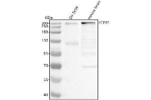 Western blot analysis of IP3 Receptor using anti-IP3 Receptor antibody (ABIN7605301).