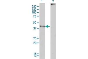 Western Blot analysis of MAGEA2 expression in transfected 293T cell line by MAGEA2 monoclonal antibody (M01), clone 1H4.