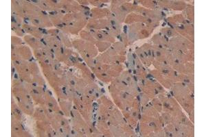 DAB staining on IHC-P; Samples: Mouse Heart Tissue (ATP2B2 anticorps  (AA 417-830))